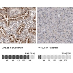 VPS28 Antibody, Novus Biologicals 0.1 mL | Buy Online | Novus Biologicals | Fisher Scientific